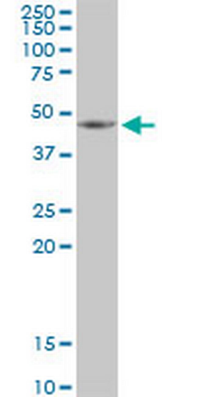 HSDL2 Antibody in Western Blot (WB)