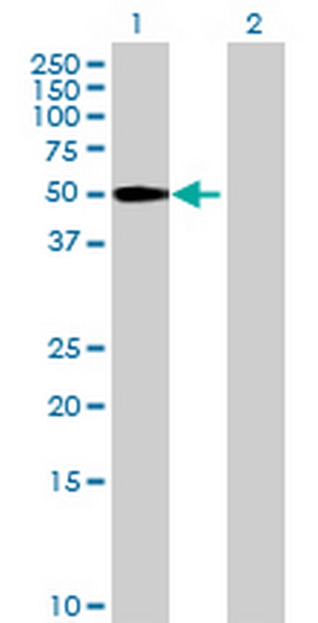 MGC4618 Antibody in Western Blot (WB)