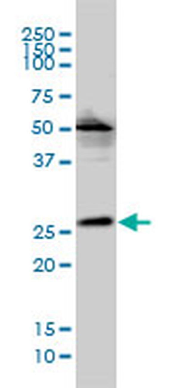 VPS25 Antibody in Western Blot (WB)