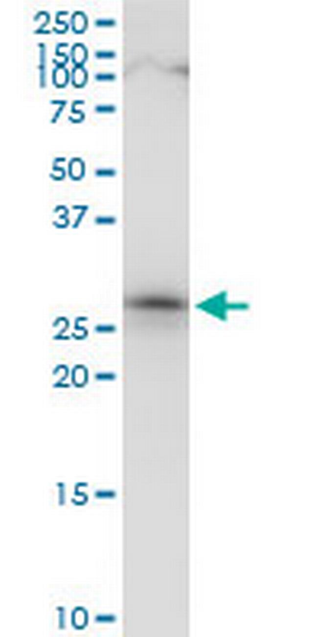 CIP29 Antibody in Western Blot (WB)