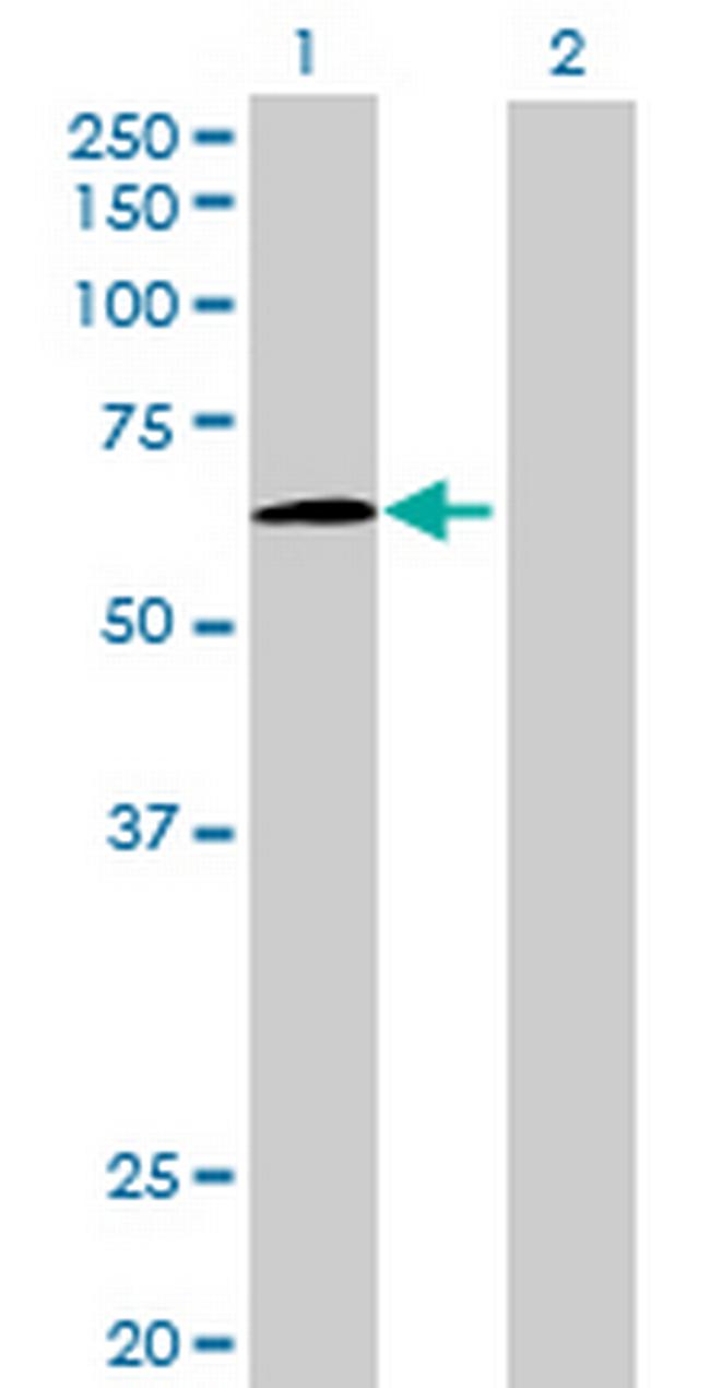 KIAA1799 Antibody in Western Blot (WB)