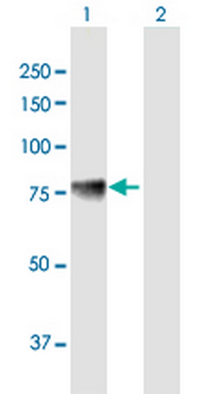 ACSS1 Antibody in Western Blot (WB)