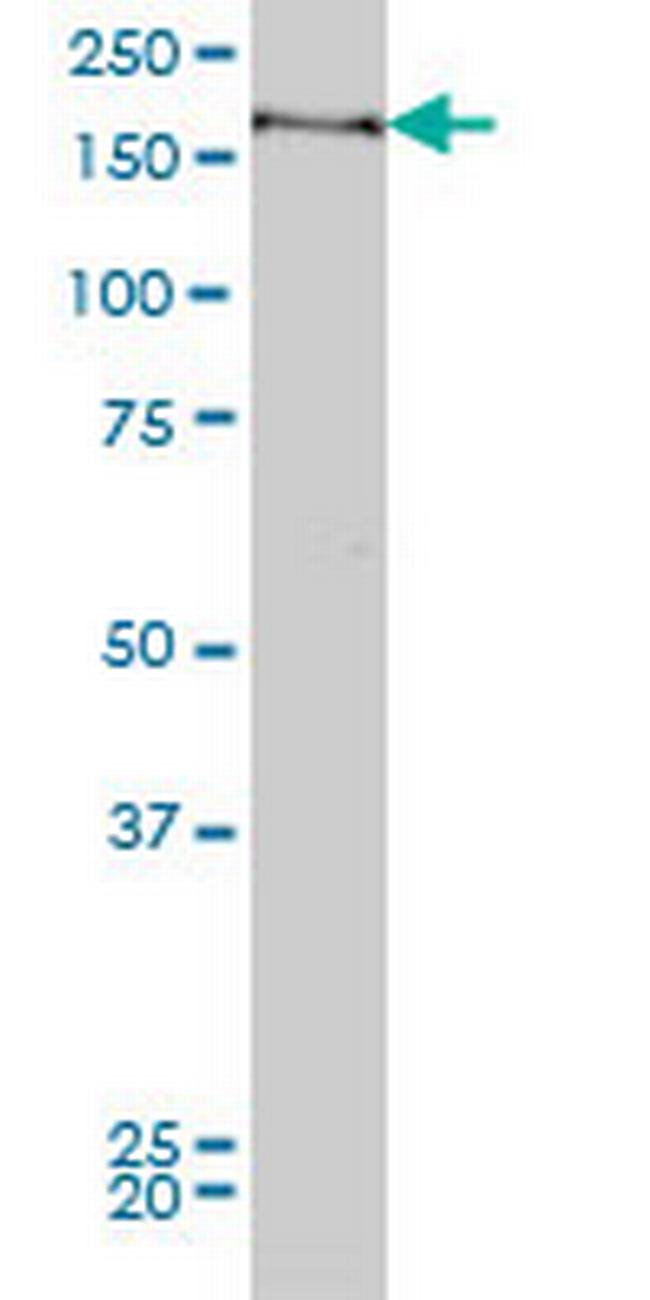 MYPN Antibody in Western Blot (WB)