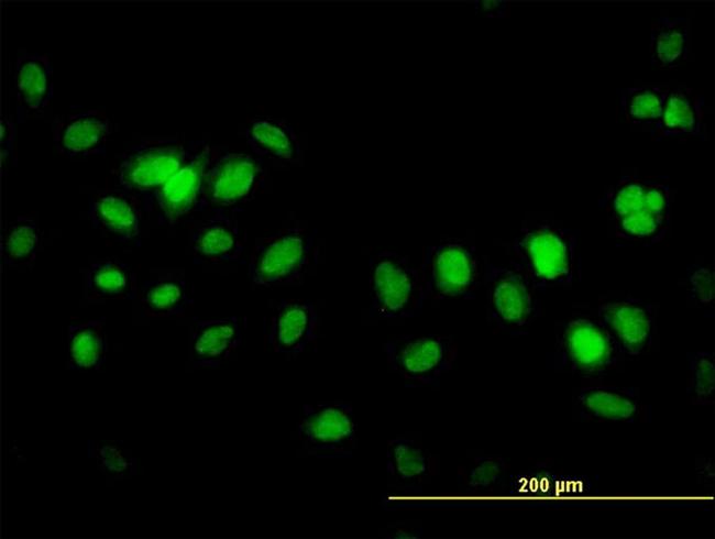 FBXL10 Antibody in Immunocytochemistry (ICC/IF)