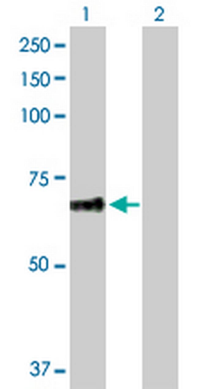 PLEKHA8 Antibody in Western Blot (WB)