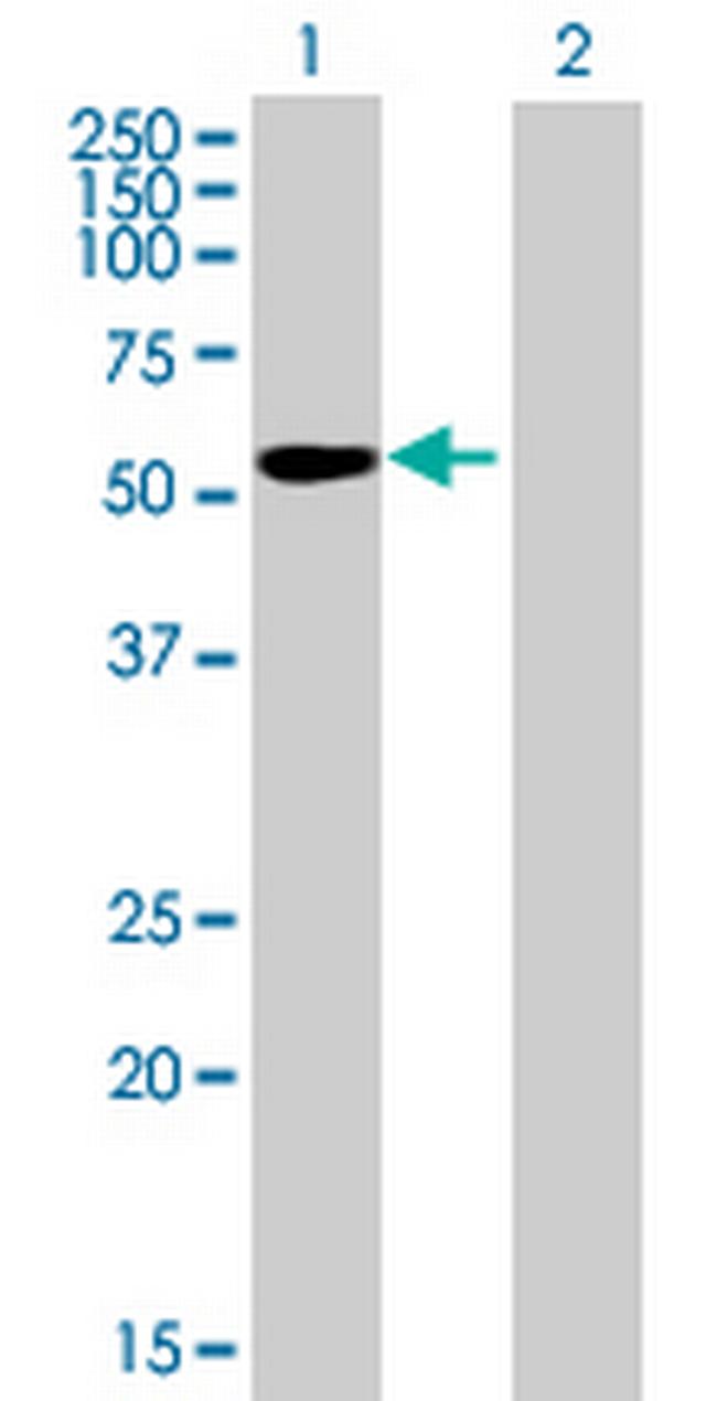 IGSF21 Antibody in Western Blot (WB)