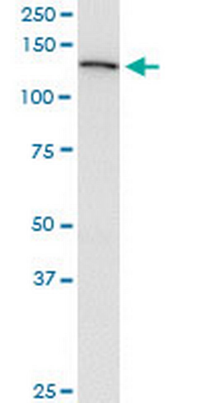 USP45 Antibody in Western Blot (WB)