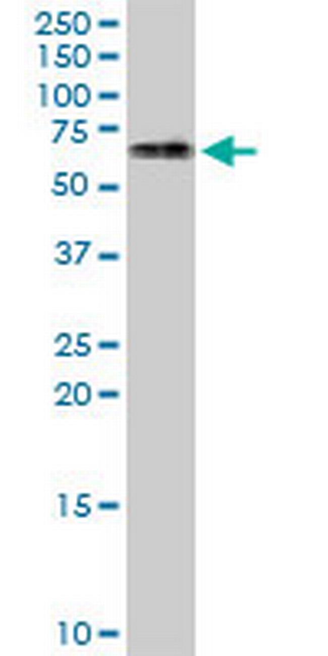 ATCAY Antibody in Western Blot (WB)