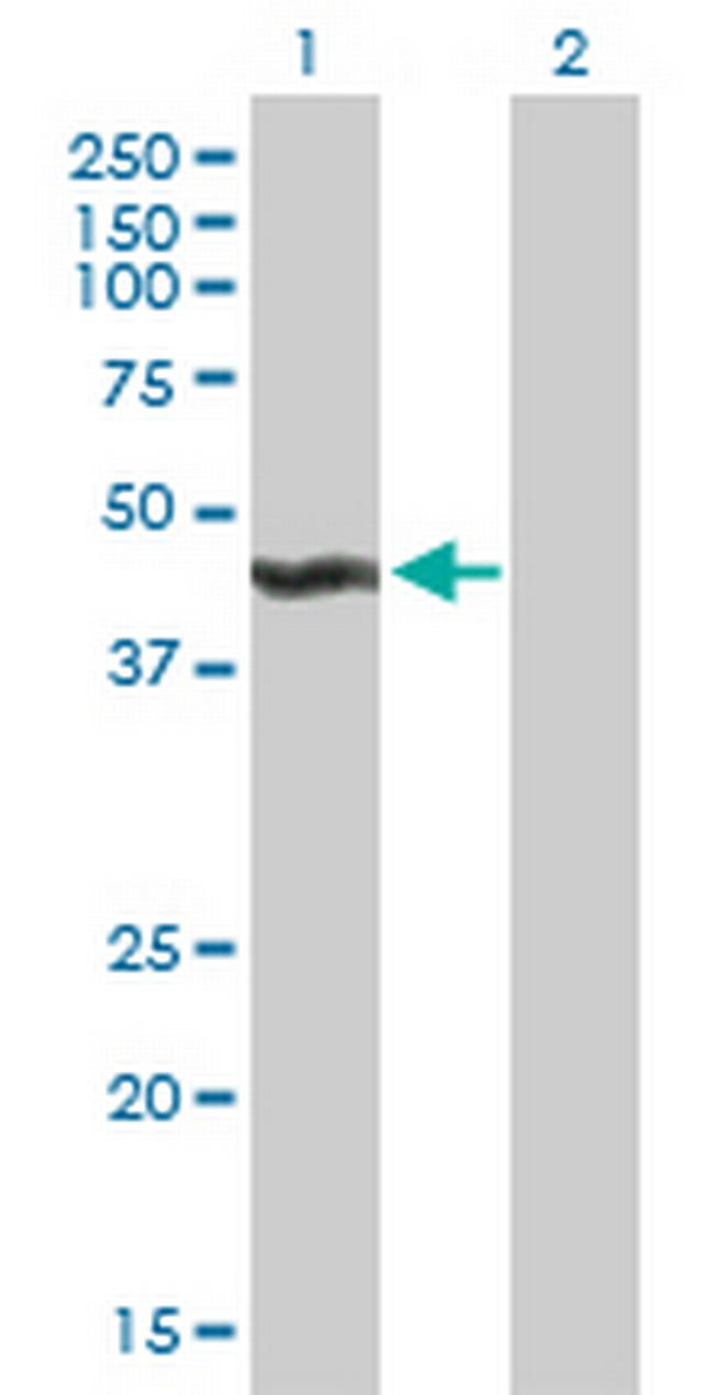 ALG2 Antibody in Western Blot (WB)