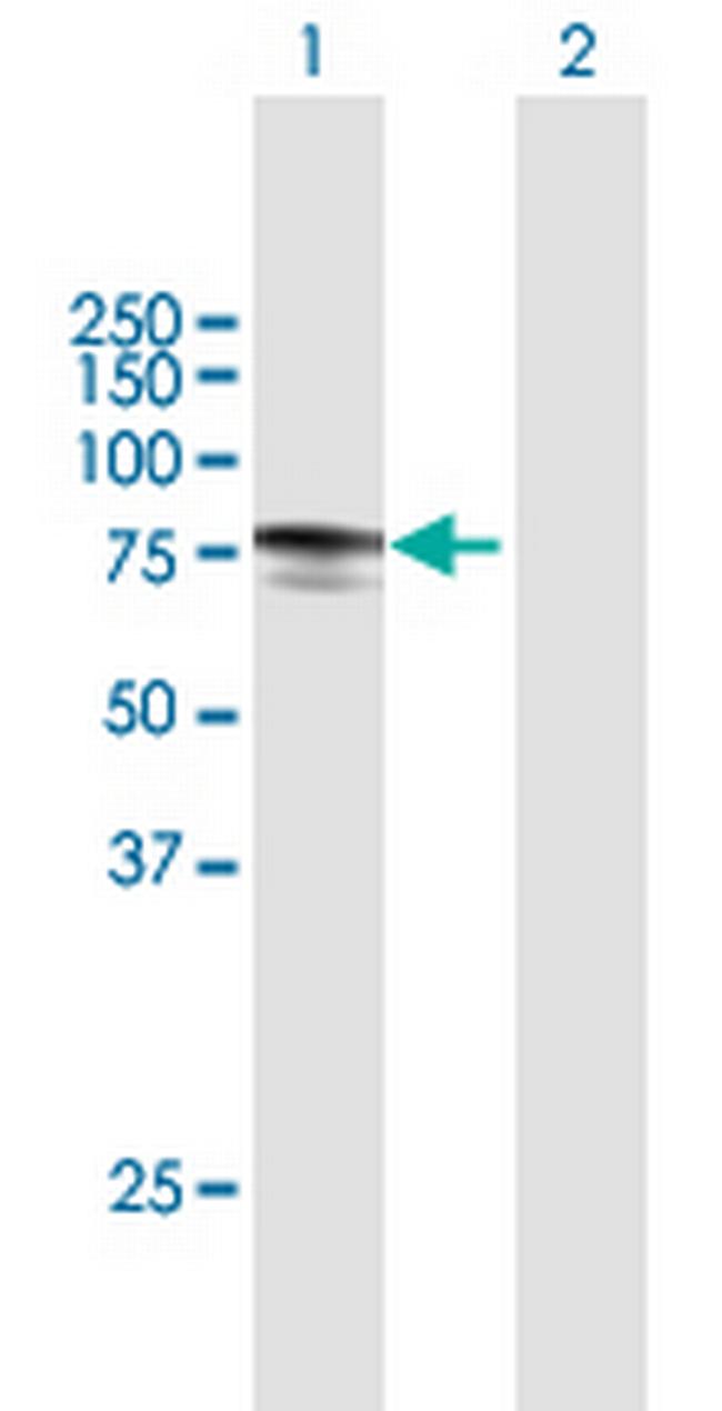 MYLK2 Antibody in Western Blot (WB)