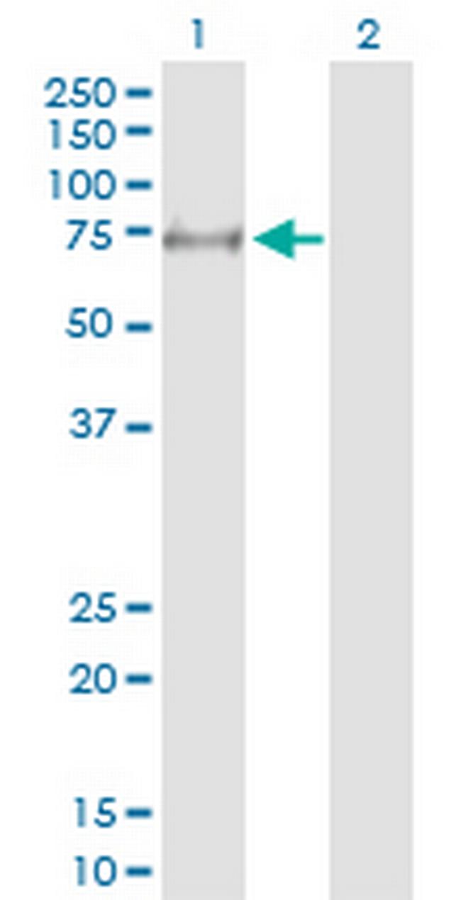 MYLK2 Antibody in Western Blot (WB)