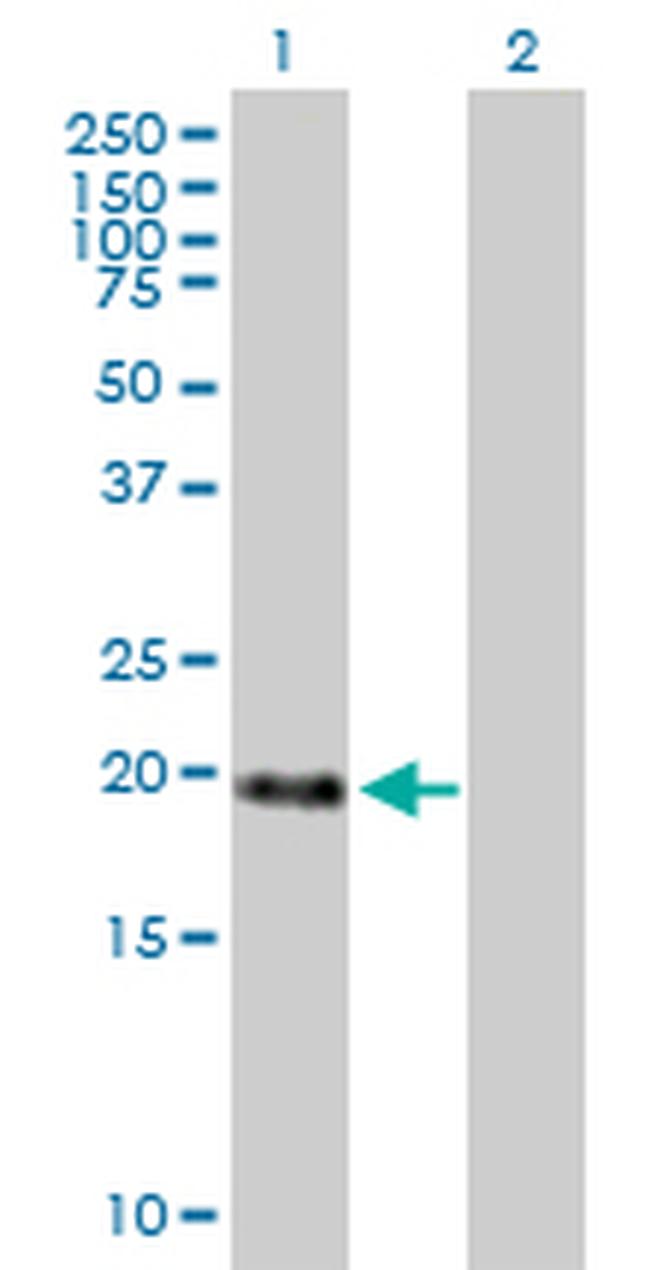 MBD3L1 Antibody in Western Blot (WB)