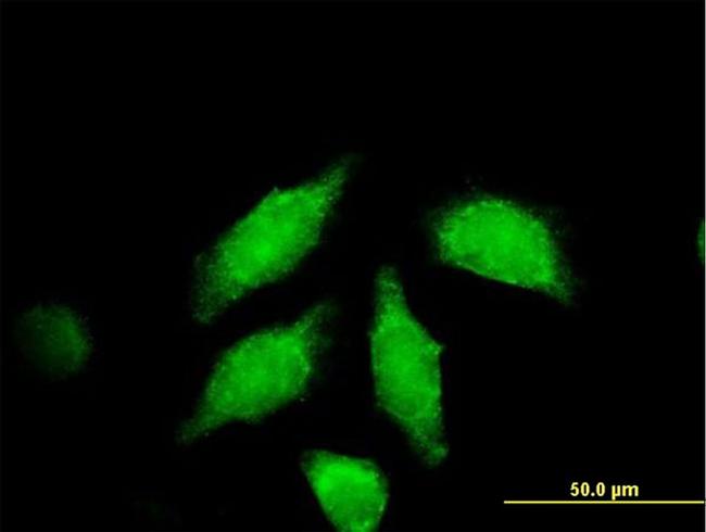 WNT3A Antibody in Immunocytochemistry (ICC/IF)