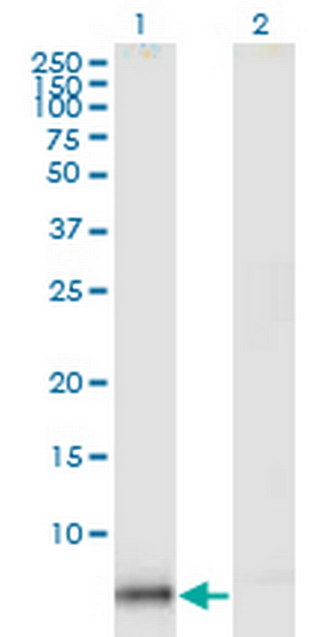 KIR3DX1 Antibody in Western Blot (WB)