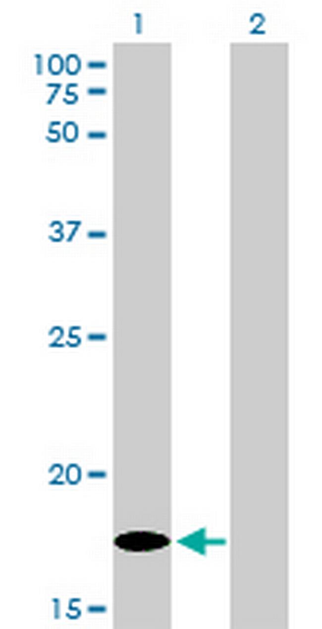 MCFD2 Antibody in Western Blot (WB)