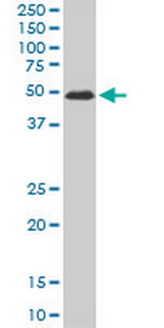 ZNF622 Antibody in Western Blot (WB)