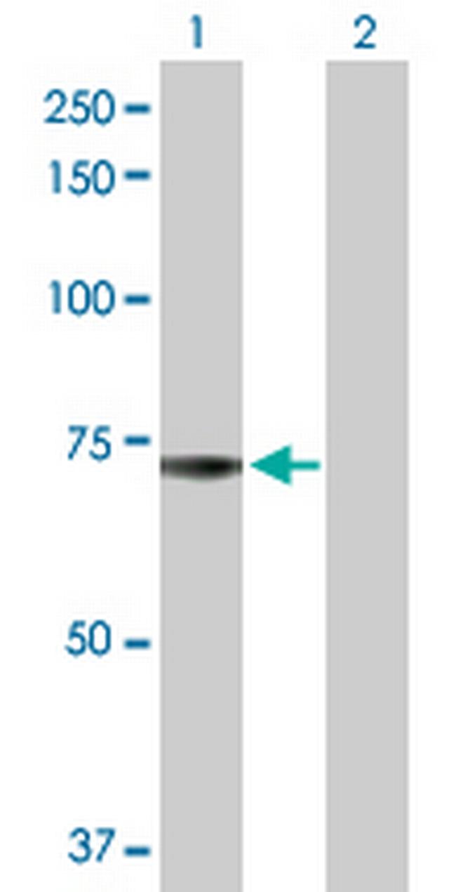 ADCK2 Antibody in Western Blot (WB)