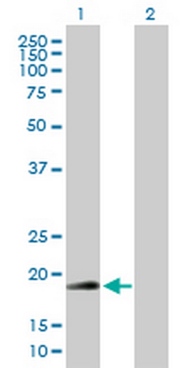 RNF185 Antibody in Western Blot (WB)