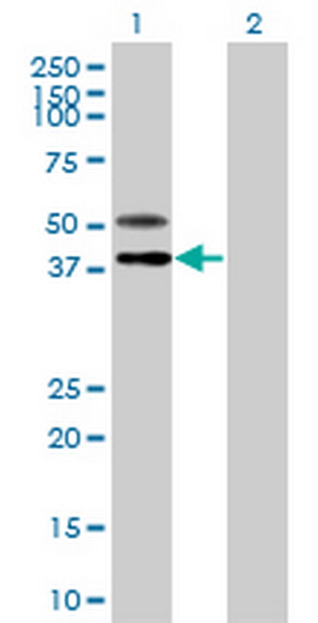 B3GNT7 Antibody in Western Blot (WB)