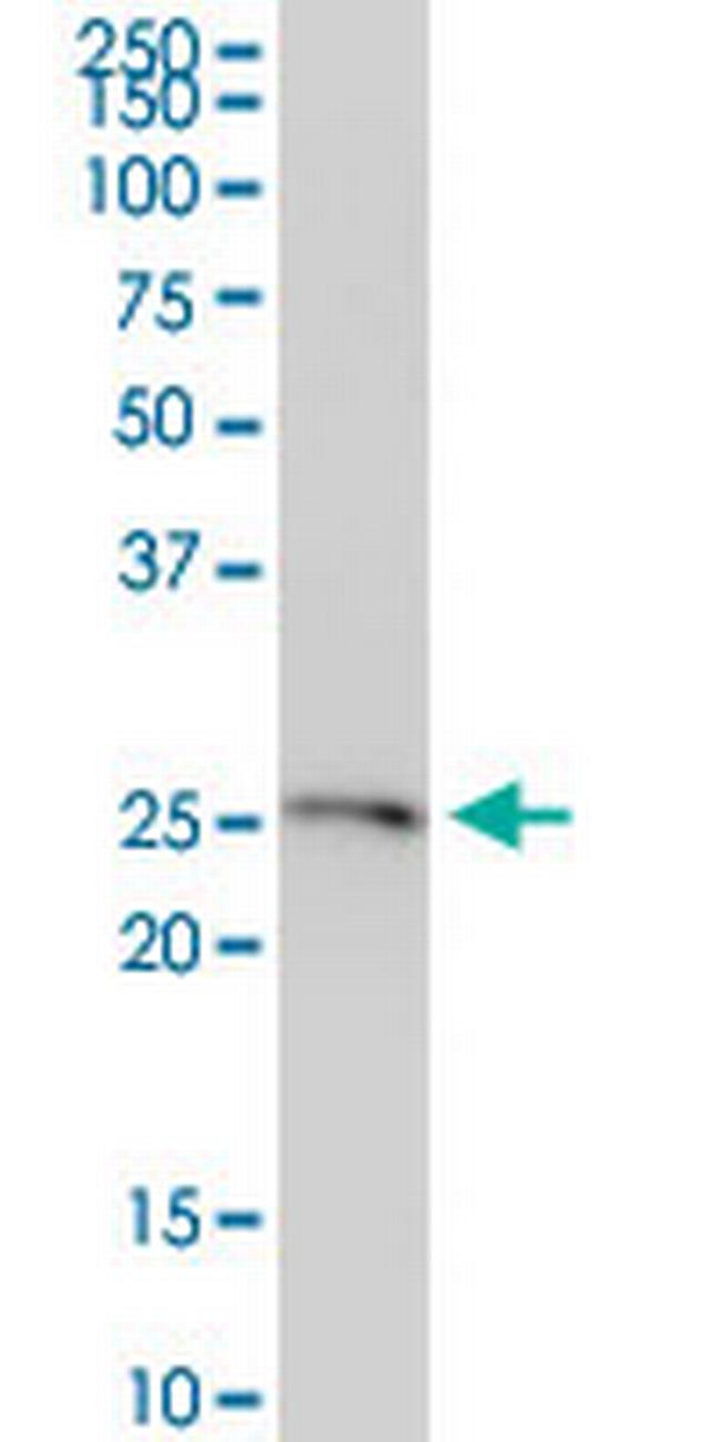 FTMT Antibody in Western Blot (WB)