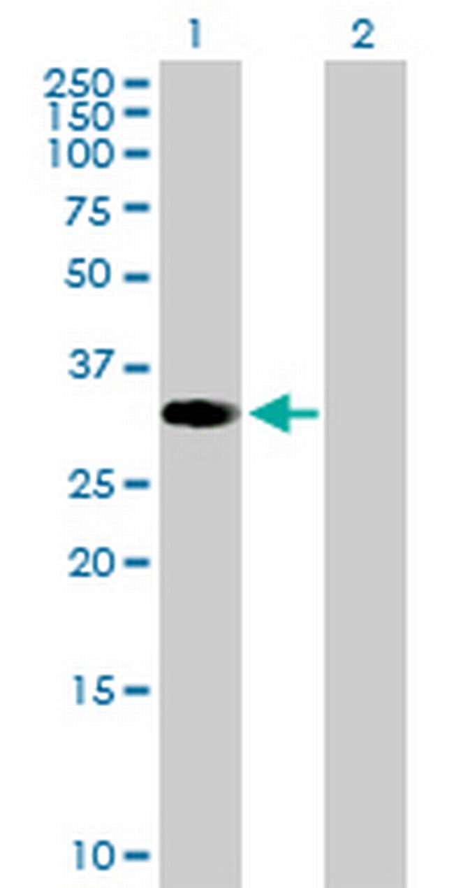 ZNF101 Antibody in Western Blot (WB)