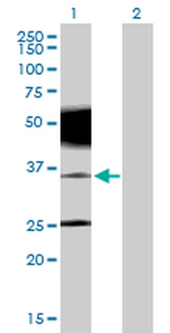 PRRT2 Antibody in Western Blot (WB)