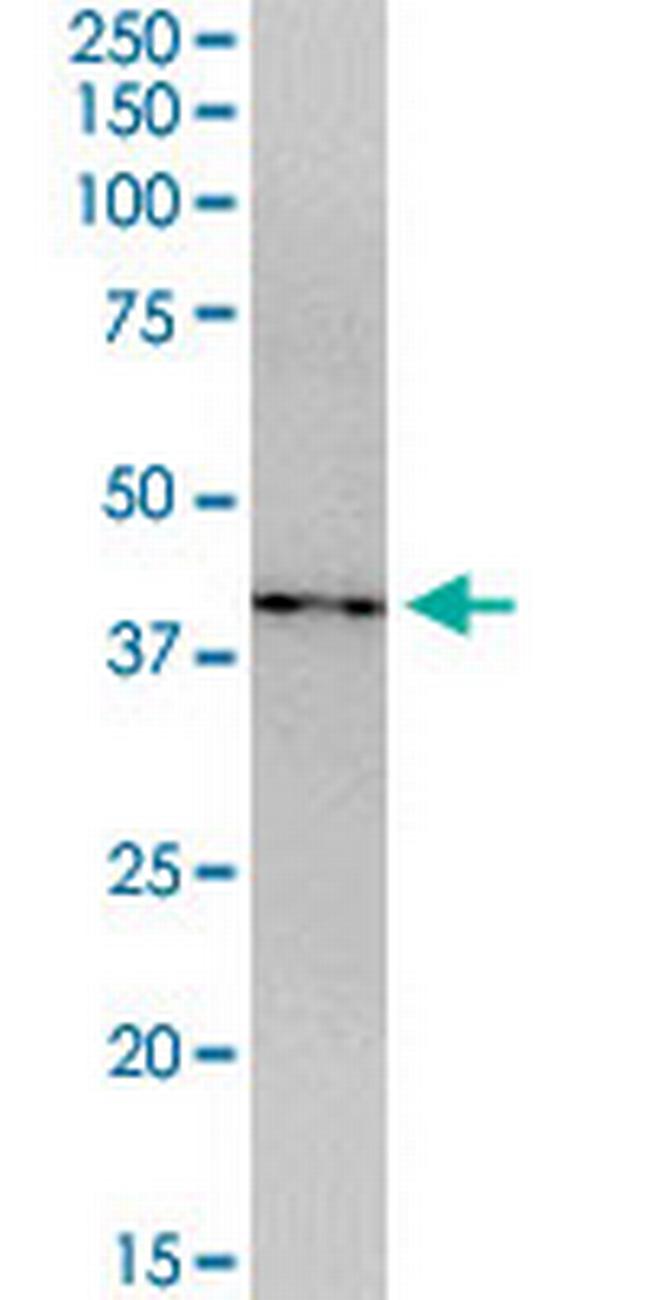 CDCA5 Antibody in Western Blot (WB)