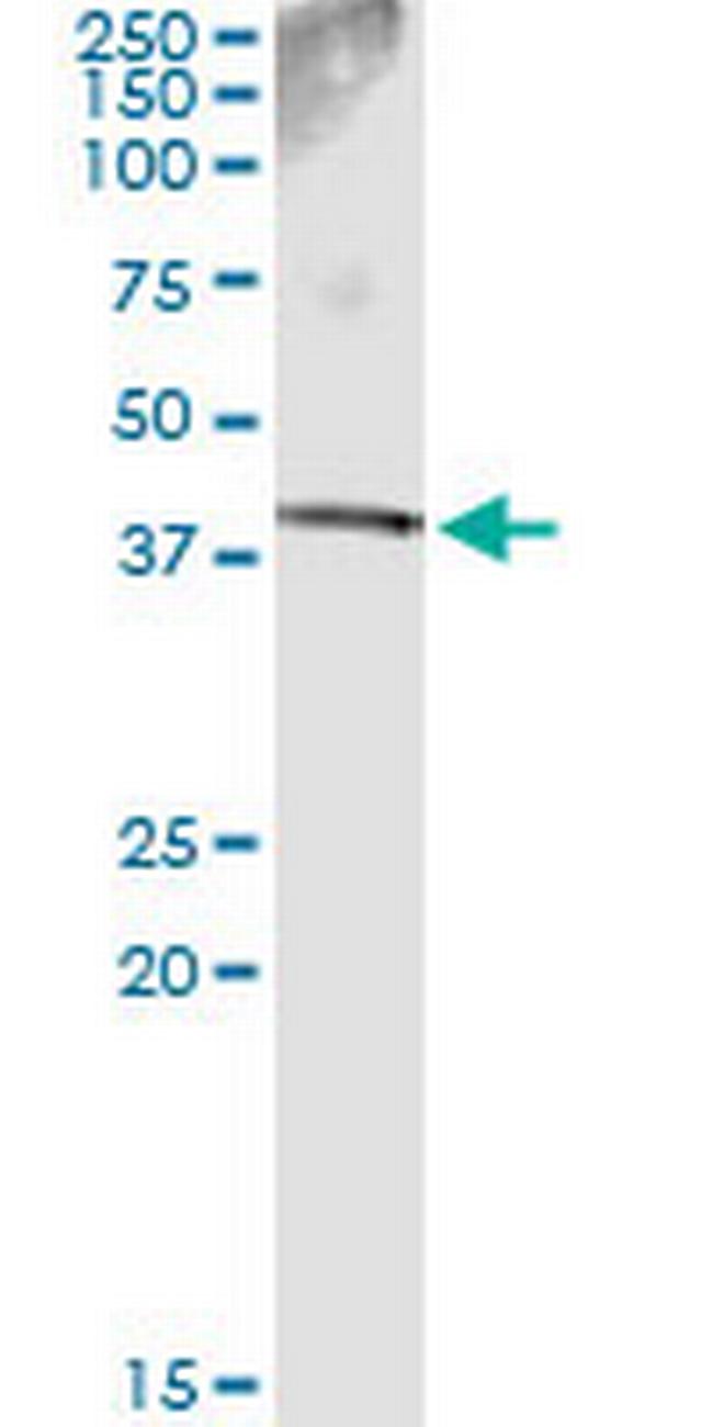 SDSL Antibody in Immunoprecipitation (IP)