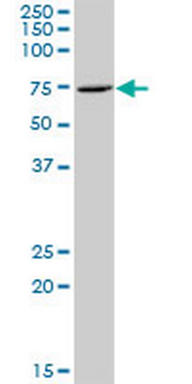 ZNF257 Antibody in Western Blot (WB)