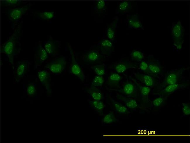 TOE1 Antibody in Immunocytochemistry (ICC/IF)