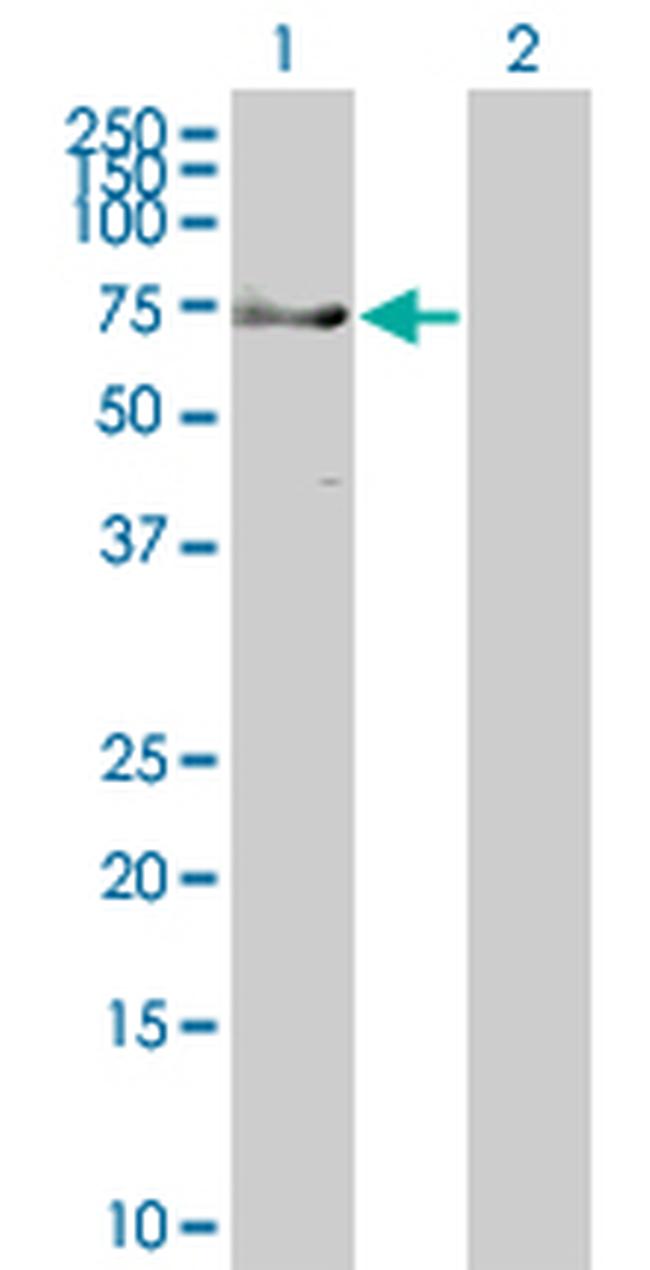 TRIM9 Antibody in Western Blot (WB)