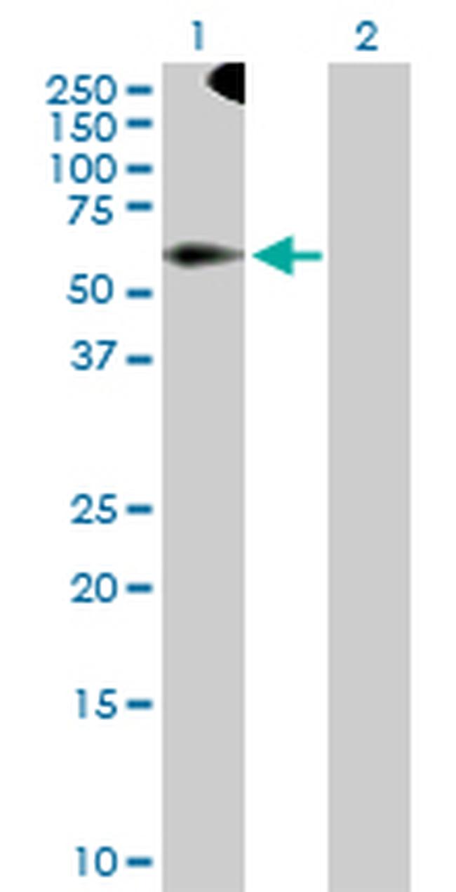 TRIM9 Antibody in Western Blot (WB)