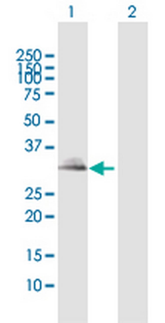 TIRAP Antibody in Western Blot (WB)