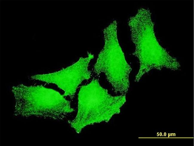 CYGB Antibody in Immunocytochemistry (ICC/IF)