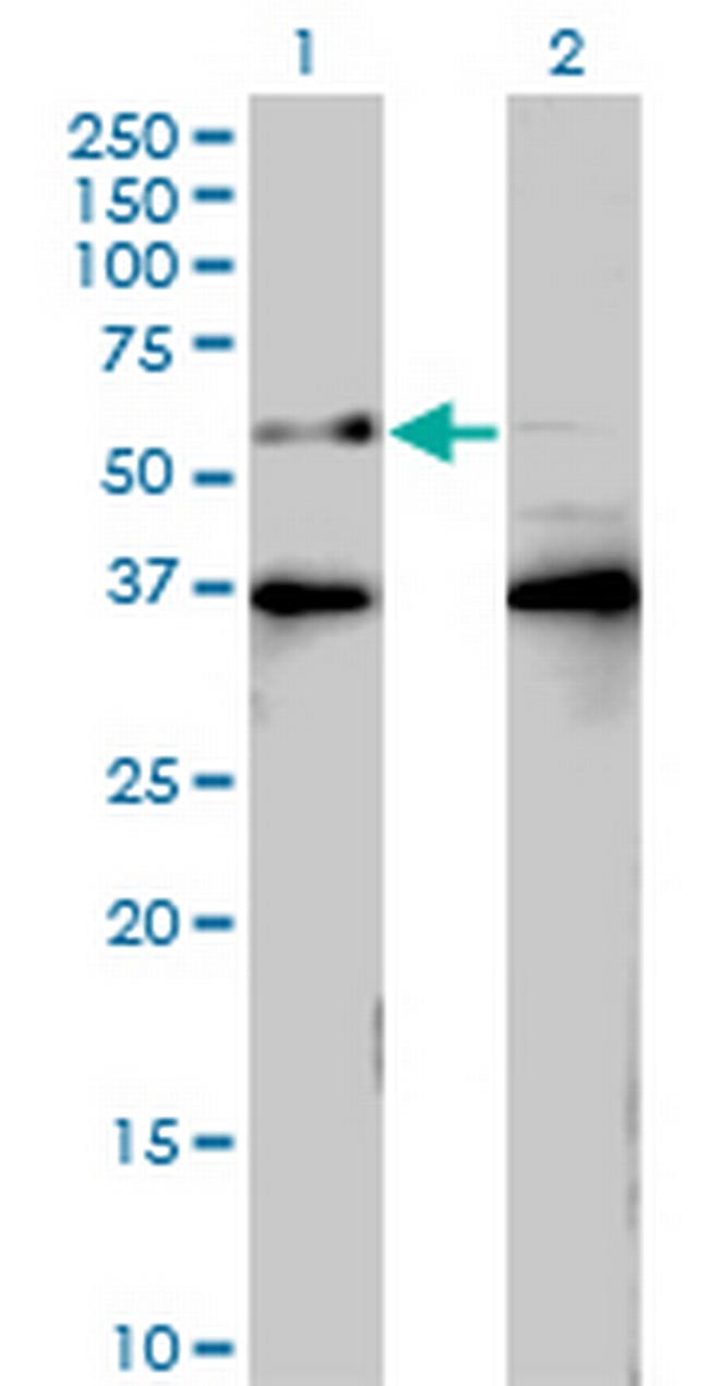 BTBD9 Antibody in Western Blot (WB)