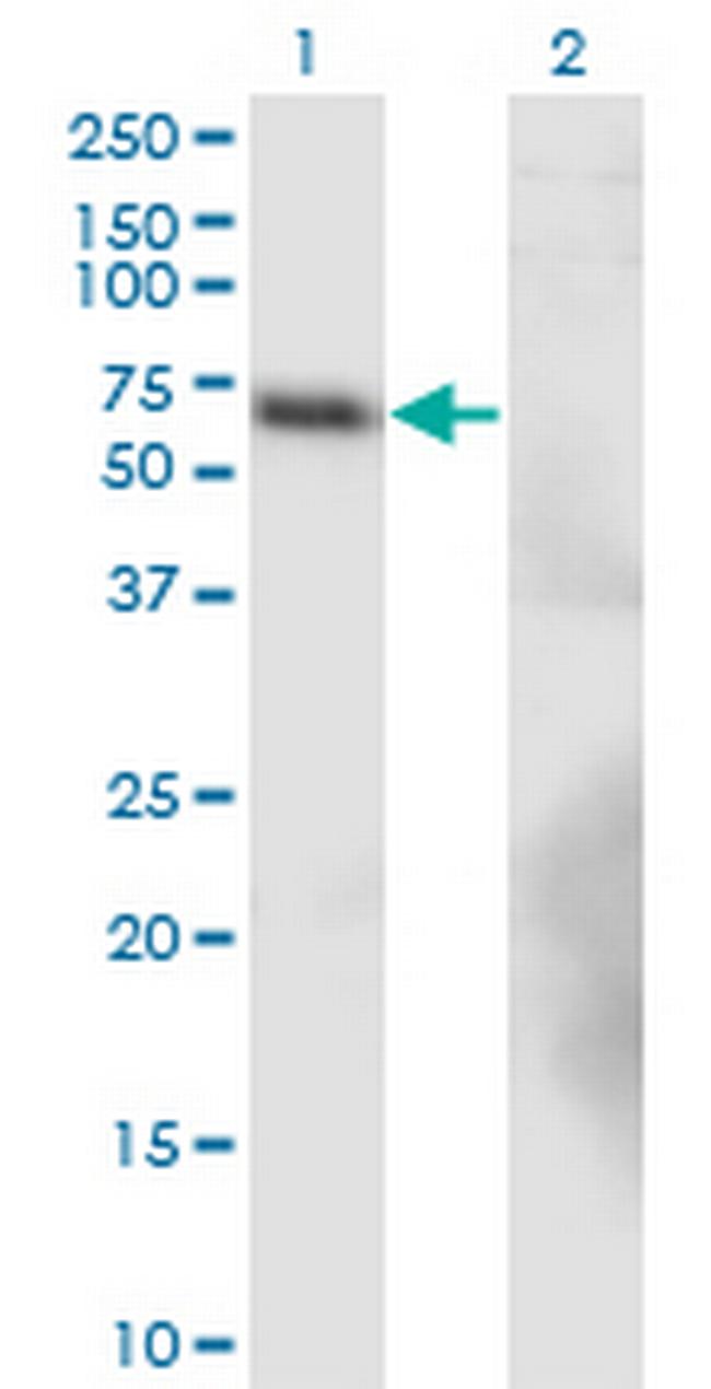 BTBD9 Antibody in Western Blot (WB)