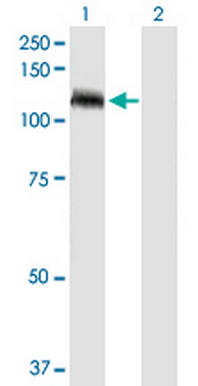 TUBGCP5 Antibody in Western Blot (WB)