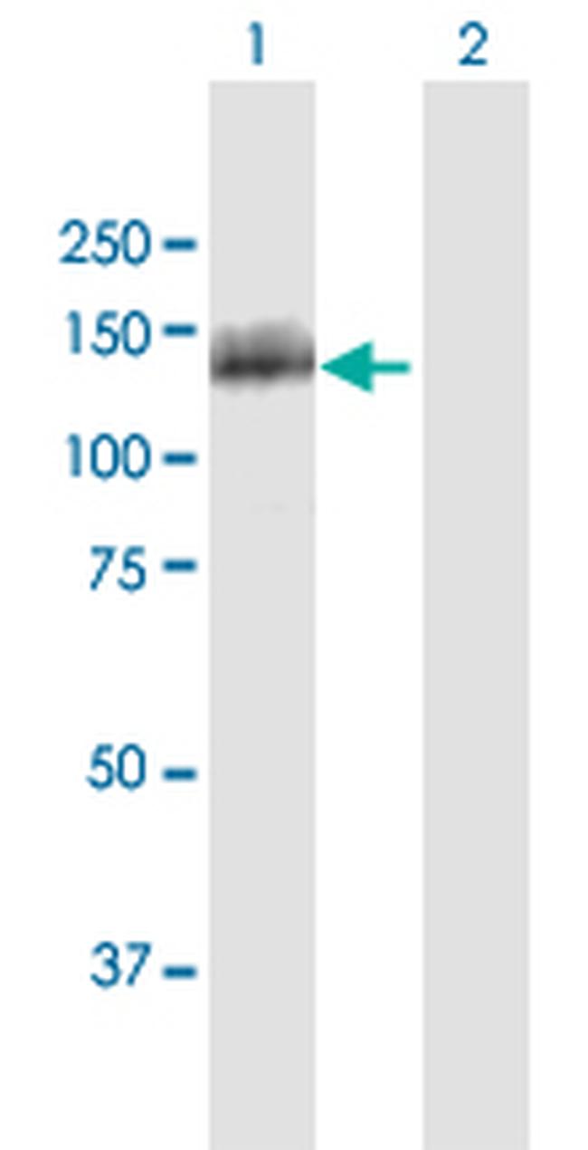 OSBPL5 Antibody in Western Blot (WB)