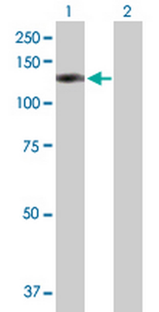 OSBPL8 Antibody in Western Blot (WB)