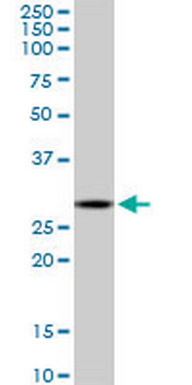 C1QTNF1 Antibody in Western Blot (WB)