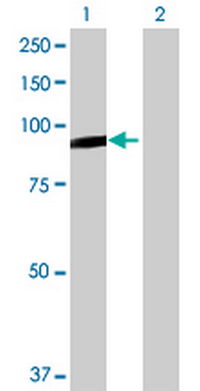 RASGRP4 Antibody in Western Blot (WB)