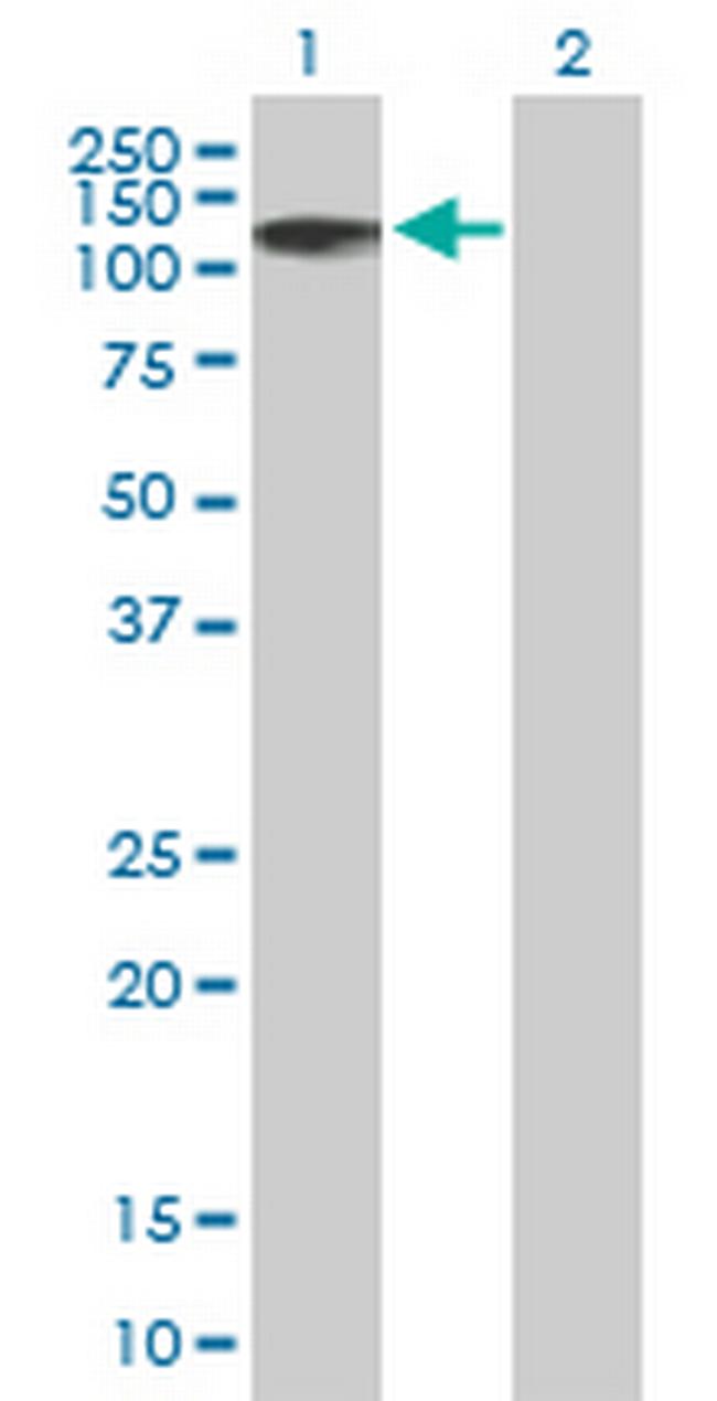 ZNF526 Antibody in Western Blot (WB)