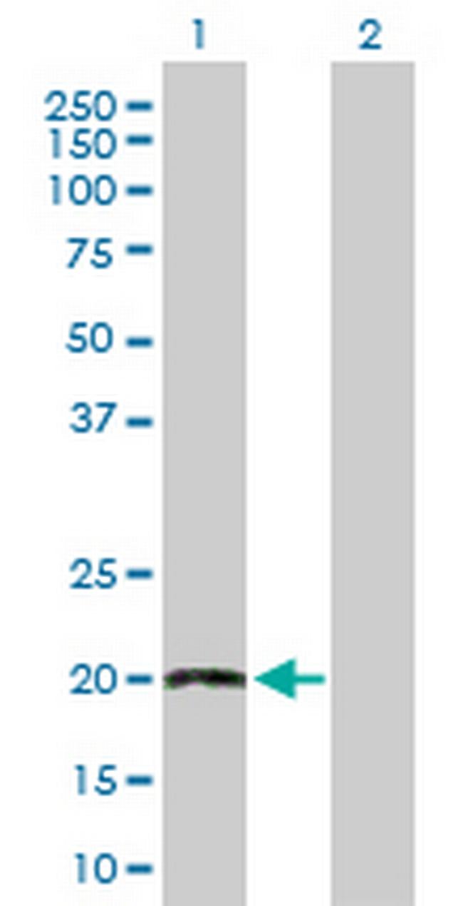 TWIST2 Antibody in Western Blot (WB)