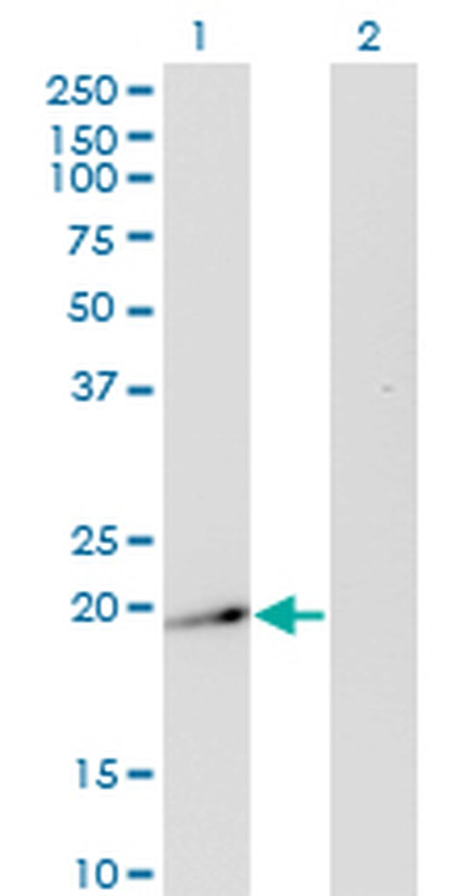 TWIST2 Antibody in Western Blot (WB)