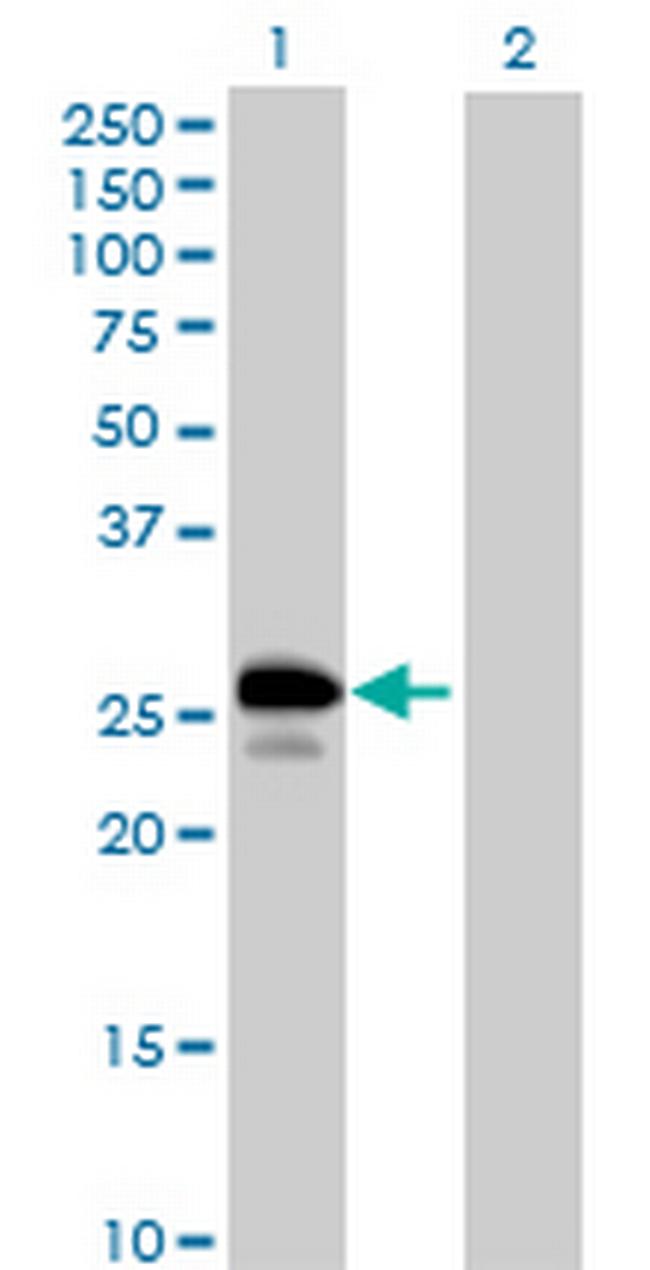 UBE2J2 Antibody in Western Blot (WB)