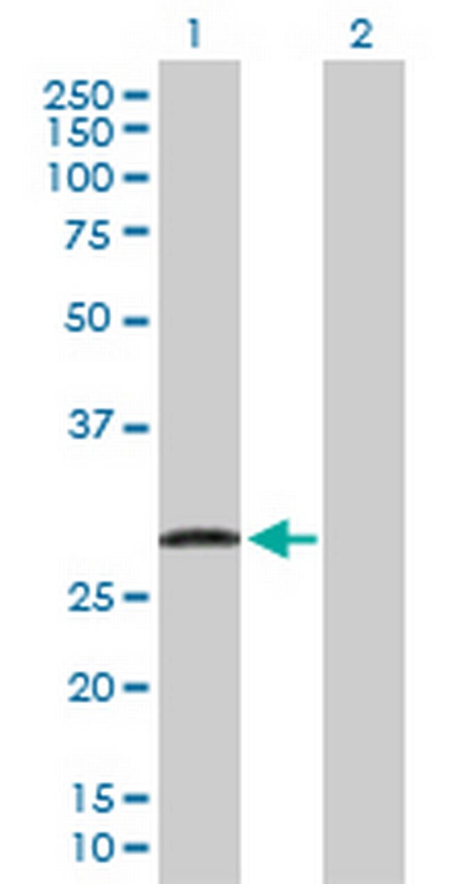 UBE2J2 Antibody in Western Blot (WB)