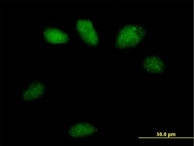 GSTO2 Antibody in Immunocytochemistry (ICC/IF)