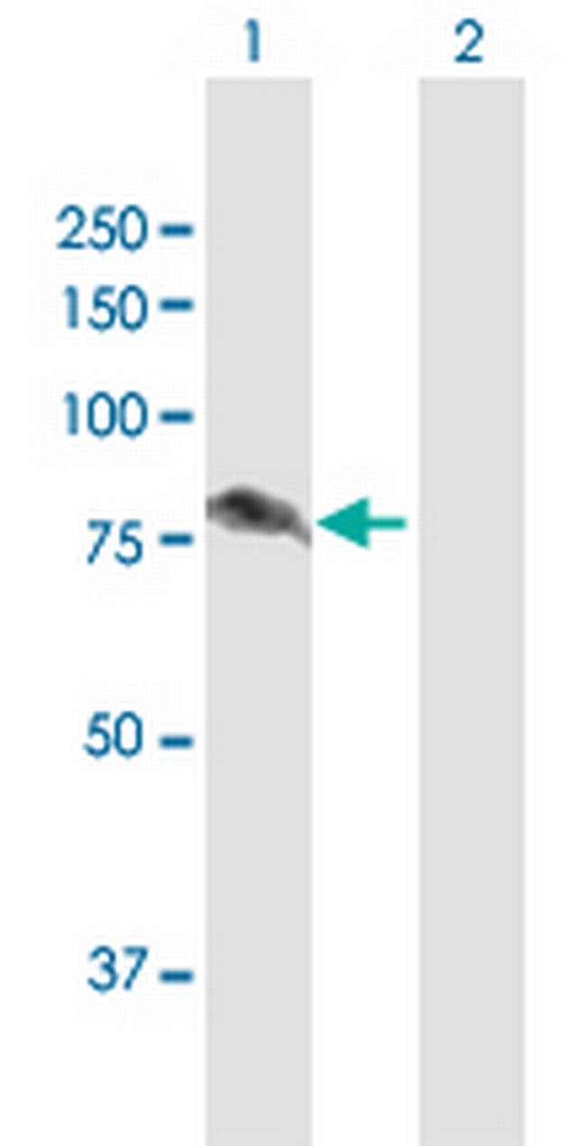 ALDH16A1 Antibody in Western Blot (WB)