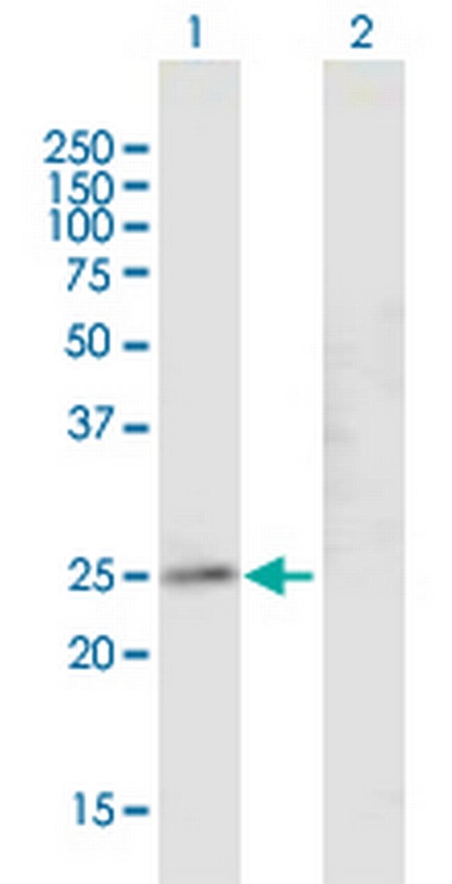 GJB4 Antibody in Western Blot (WB)