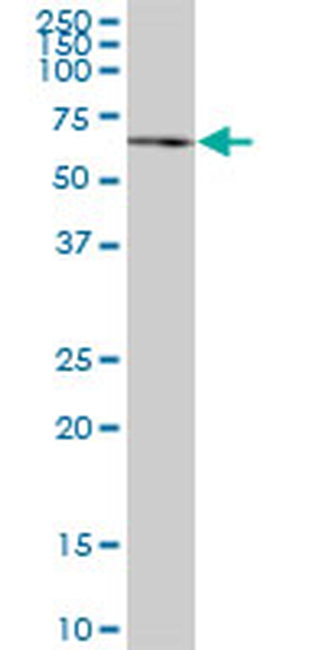 JMY Antibody in Western Blot (WB)